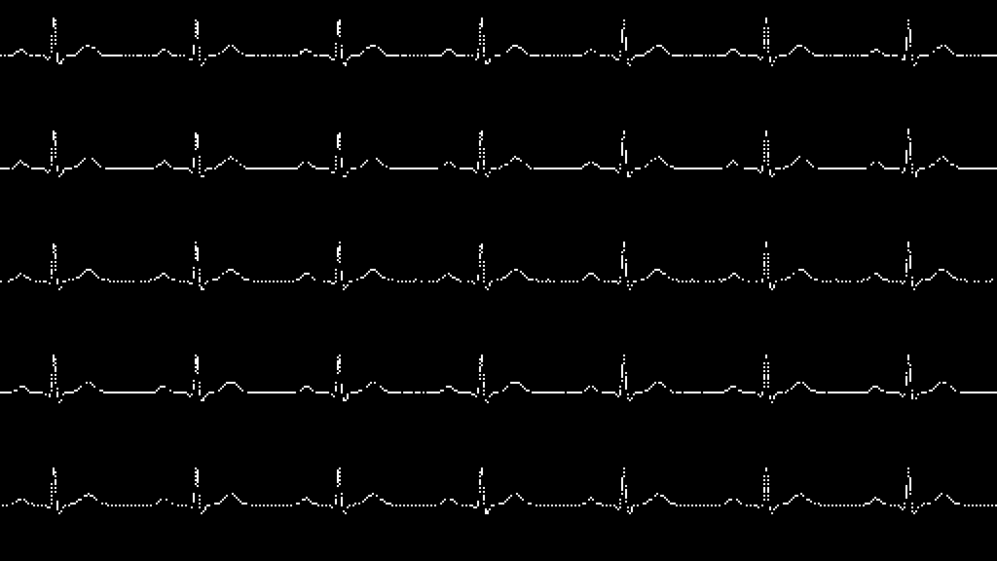 12-lead ECG waveform